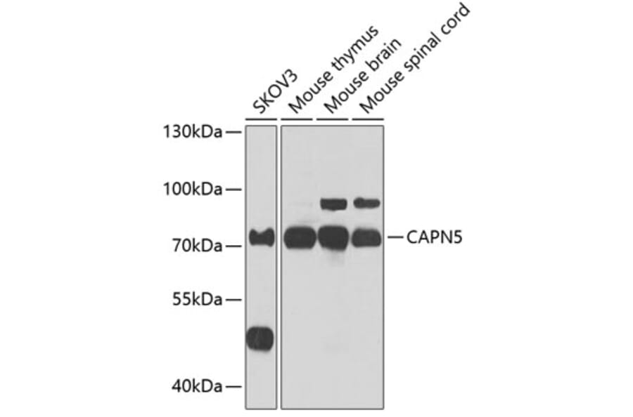 Western Blot - Anti-Calpain 5 Antibody (A15689) - Antibodies.com