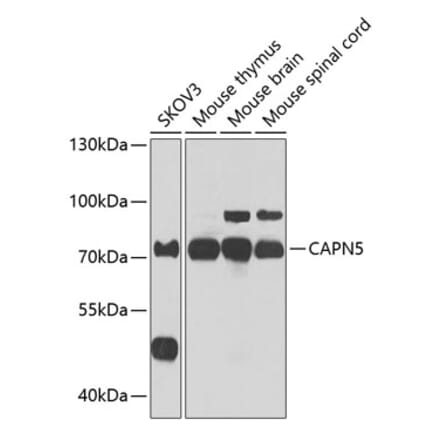 Western Blot - Anti-Calpain 5 Antibody (A15689) - Antibodies.com