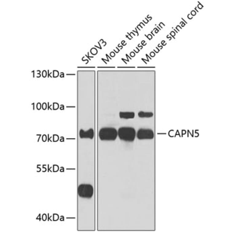 Western Blot - Anti-Calpain 5 Antibody (A15689) - Antibodies.com