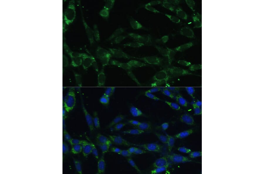 Immunofluorescence - Anti-Calpain 5 Antibody (A15689) - Antibodies.com