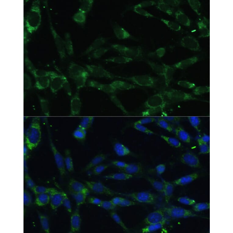 Immunofluorescence - Anti-Calpain 5 Antibody (A15689) - Antibodies.com