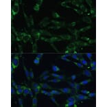 Immunofluorescence - Anti-Calpain 5 Antibody (A15689) - Antibodies.com