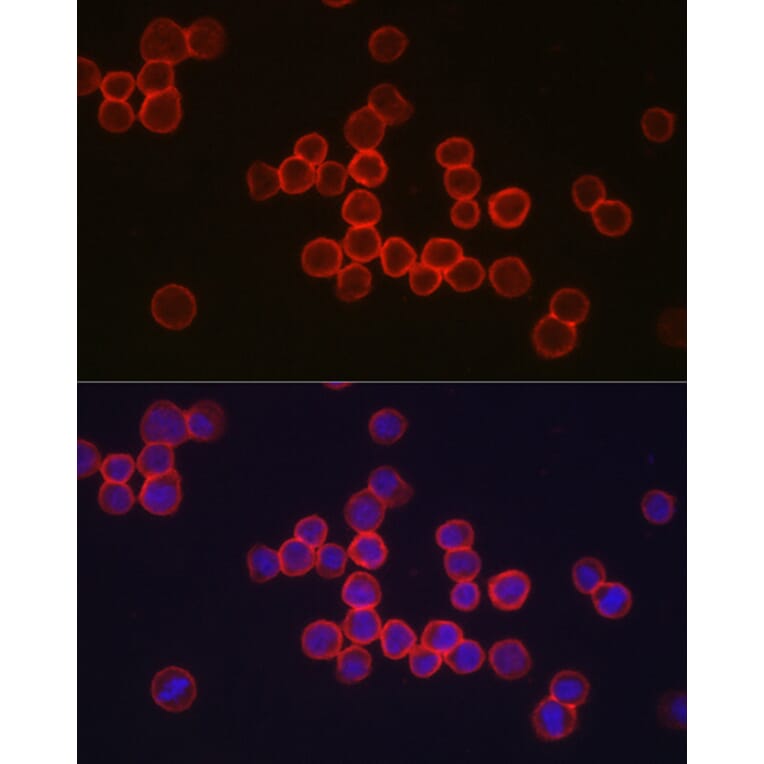 Immunofluorescence - Anti-CD34 Antibody (A15690) - Antibodies.com