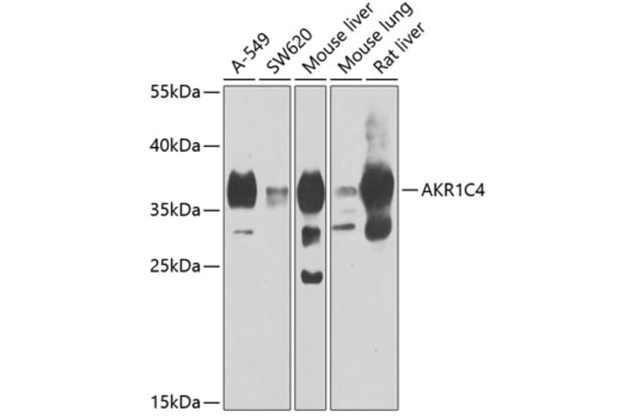 Western Blot - Anti-AKR1C4 Antibody (A15691) - Antibodies.com