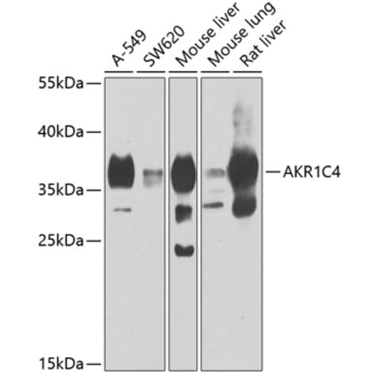Western Blot - Anti-AKR1C4 Antibody (A15691) - Antibodies.com