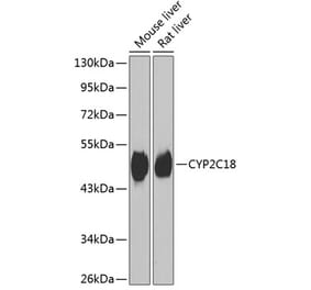 Western Blot - Anti-CYP2C18 Antibody (A15692) - Antibodies.com