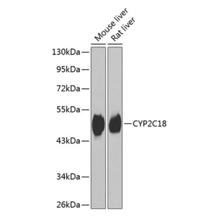 Western Blot - Anti-CYP2C18 Antibody (A15692) - Antibodies.com