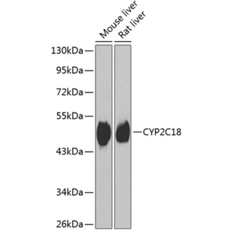 Western Blot - Anti-CYP2C18 Antibody (A15692) - Antibodies.com