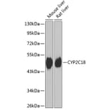 Western Blot - Anti-CYP2C18 Antibody (A15692) - Antibodies.com