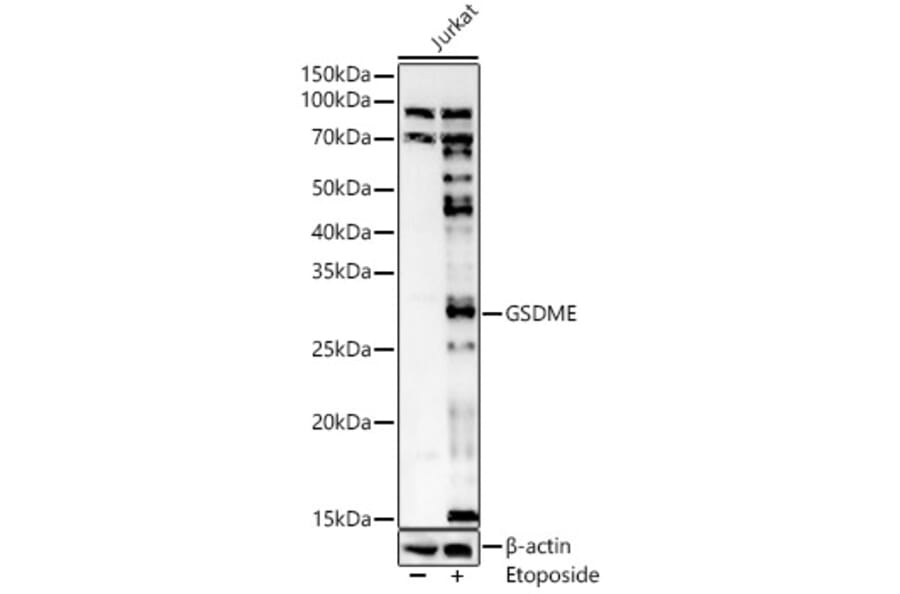 Western Blot - Anti-DFNA5/GSDME Antibody (A15693) - Antibodies.com