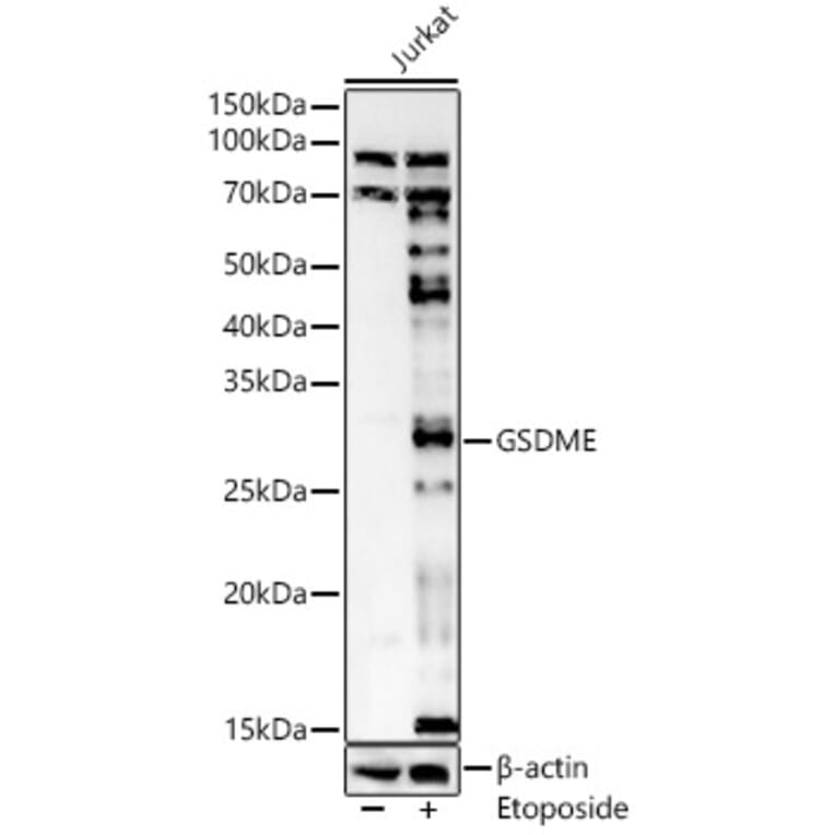 Western Blot - Anti-DFNA5/GSDME Antibody (A15693) - Antibodies.com