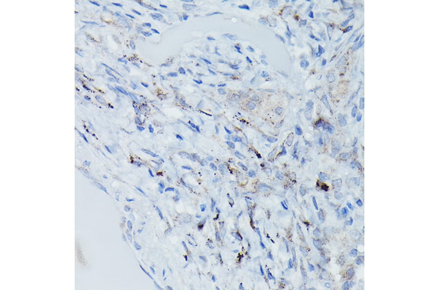 Immunohistochemistry - Anti-DFNA5/GSDME Antibody (A15693) - Antibodies.com