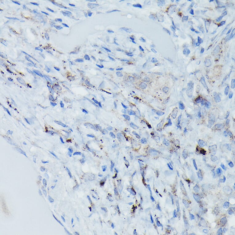 Immunohistochemistry - Anti-DFNA5/GSDME Antibody (A15693) - Antibodies.com