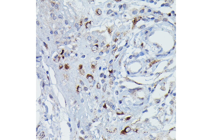 Immunohistochemistry - Anti-DFNA5/GSDME Antibody (A15693) - Antibodies.com