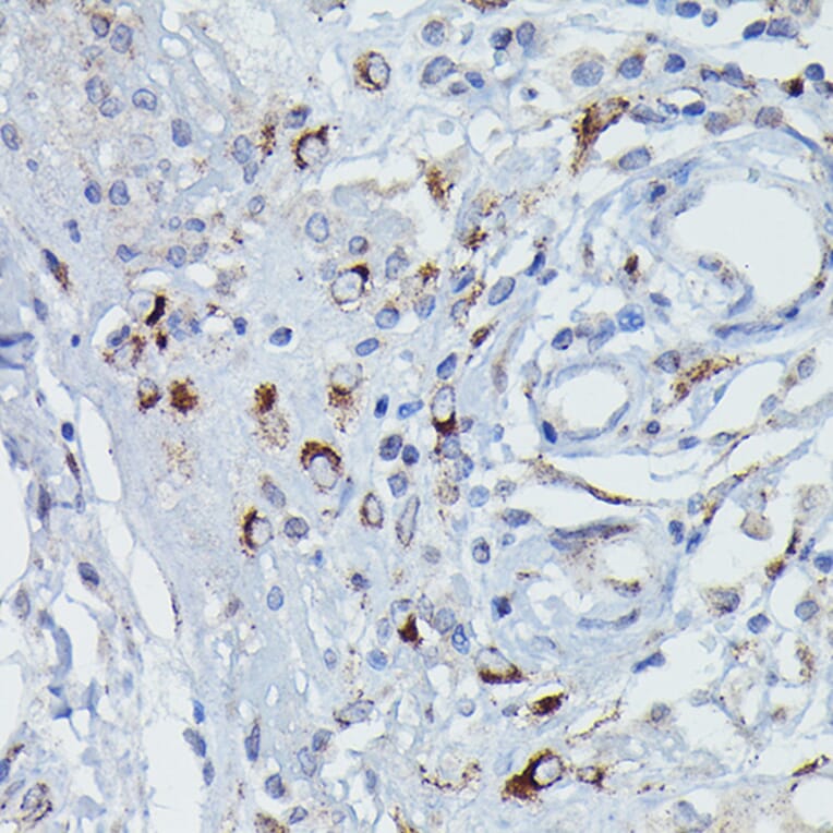 Immunohistochemistry - Anti-DFNA5/GSDME Antibody (A15693) - Antibodies.com