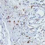 Immunohistochemistry - Anti-DFNA5/GSDME Antibody (A15693) - Antibodies.com