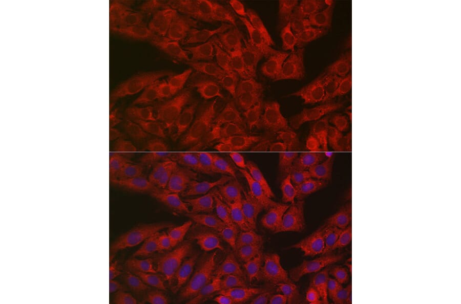 Immunofluorescence - Anti-DFNA5/GSDME Antibody (A15693) - Antibodies.com