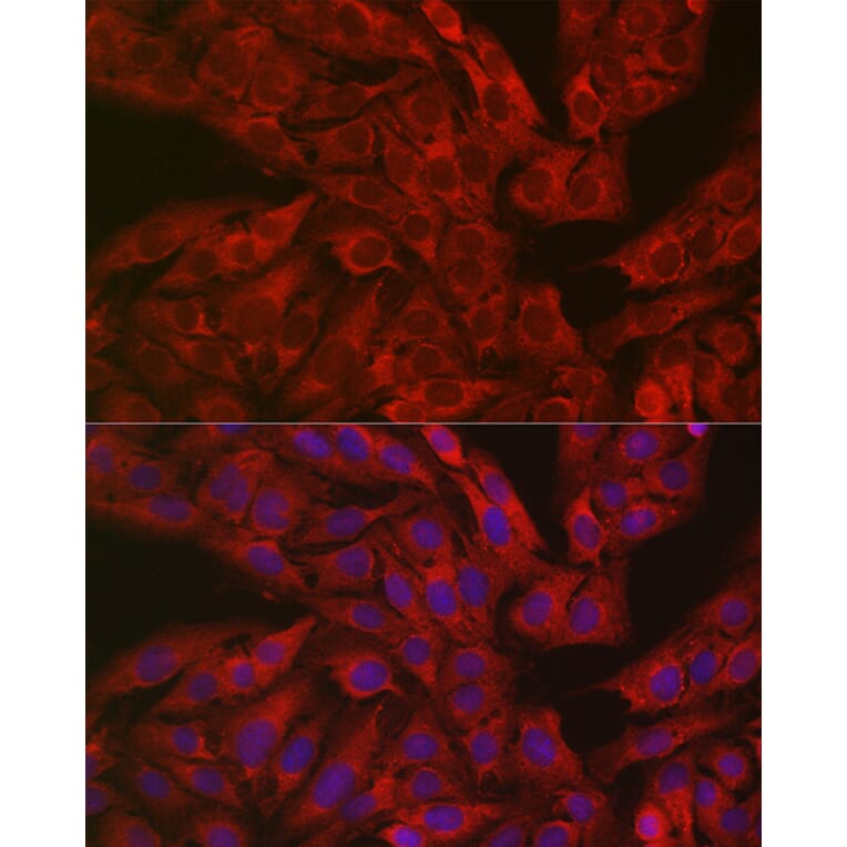 Immunofluorescence - Anti-DFNA5/GSDME Antibody (A15693) - Antibodies.com