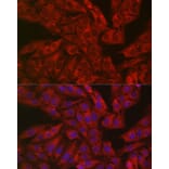 Immunofluorescence - Anti-DFNA5/GSDME Antibody (A15693) - Antibodies.com
