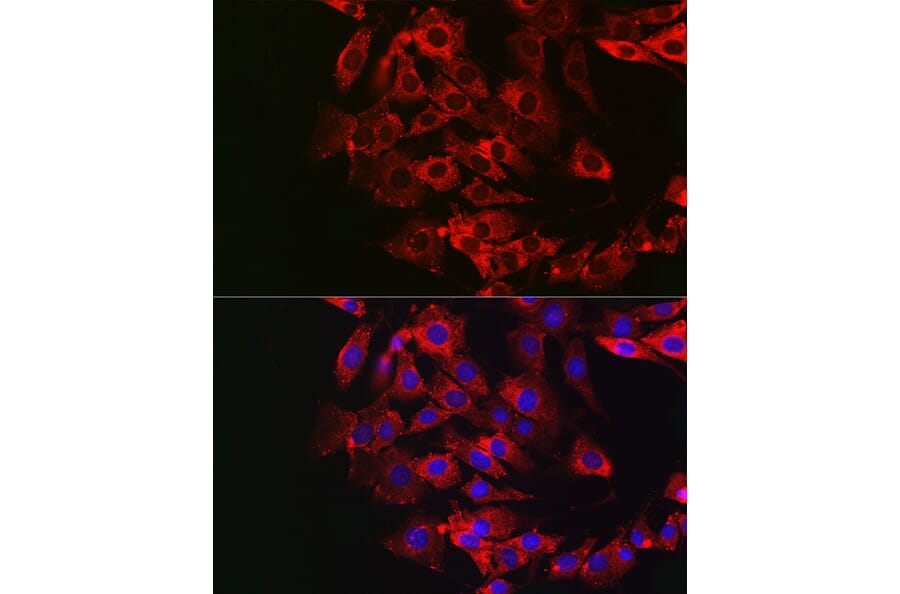 Immunofluorescence - Anti-DFNA5/GSDME Antibody (A15693) - Antibodies.com