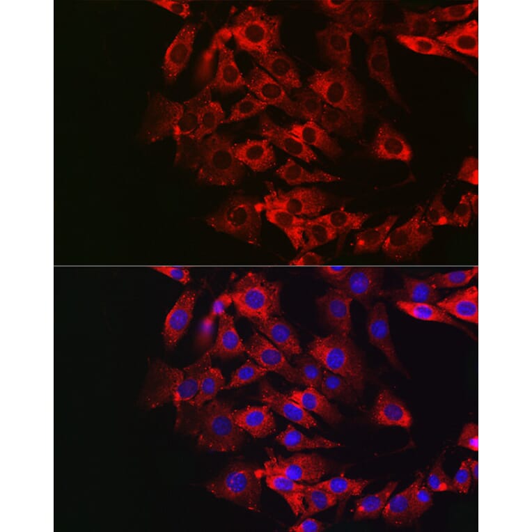 Immunofluorescence - Anti-DFNA5/GSDME Antibody (A15693) - Antibodies.com