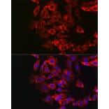 Immunofluorescence - Anti-DFNA5/GSDME Antibody (A15693) - Antibodies.com