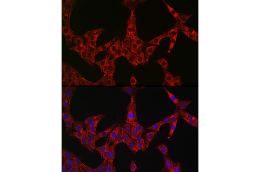Immunofluorescence - Anti-DFNA5/GSDME Antibody (A15693) - Antibodies.com