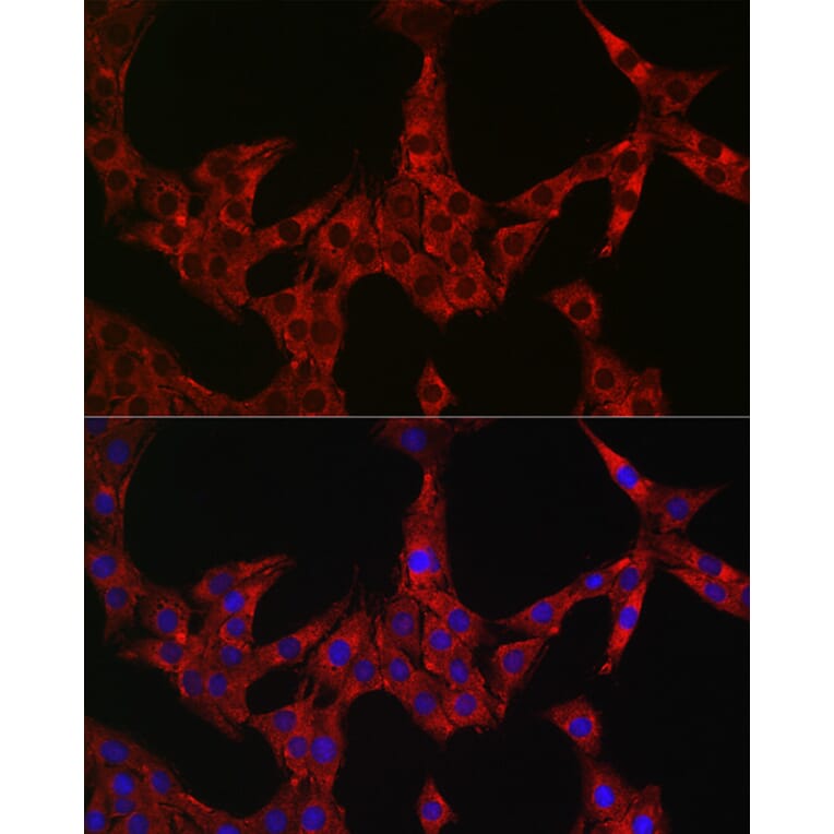 Immunofluorescence - Anti-DFNA5/GSDME Antibody (A15693) - Antibodies.com