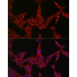 Immunofluorescence - Anti-DFNA5/GSDME Antibody (A15693) - Antibodies.com