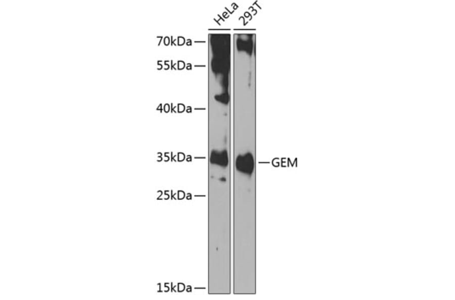 Western Blot - Anti-GEM Antibody (A15694) - Antibodies.com