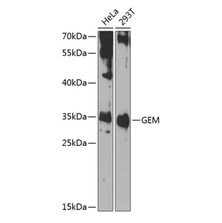 Western Blot - Anti-GEM Antibody (A15694) - Antibodies.com