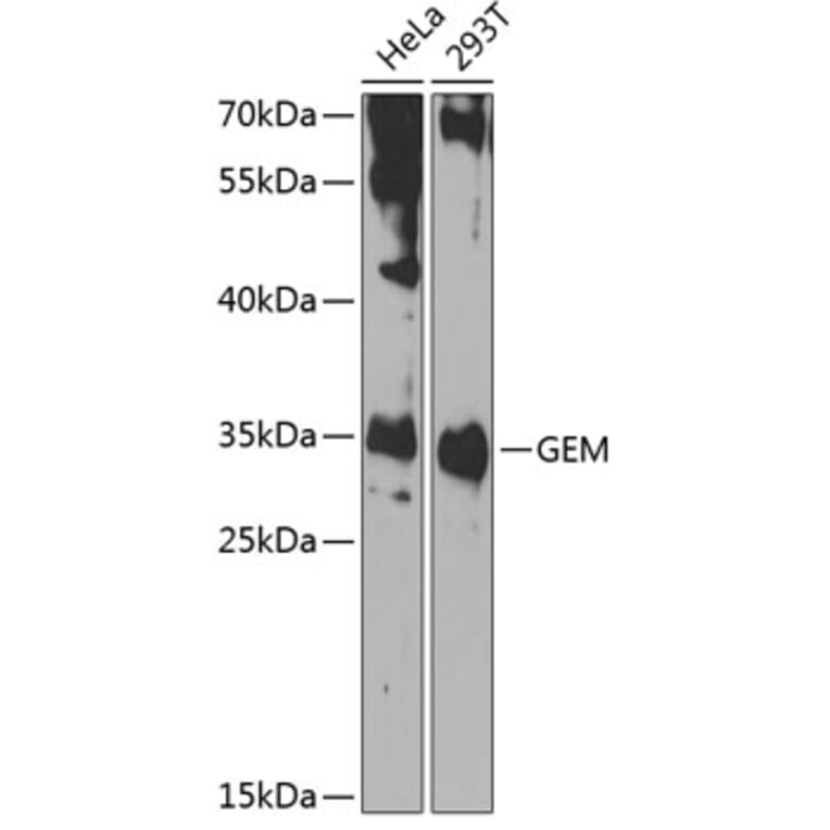 Western Blot - Anti-GEM Antibody (A15694) - Antibodies.com