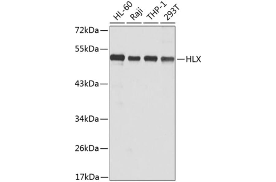 Western Blot - Anti-HLX1 Antibody (A15695) - Antibodies.com