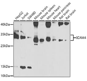 Western Blot - Anti-ICAM4 Antibody (A15697) - Antibodies.com