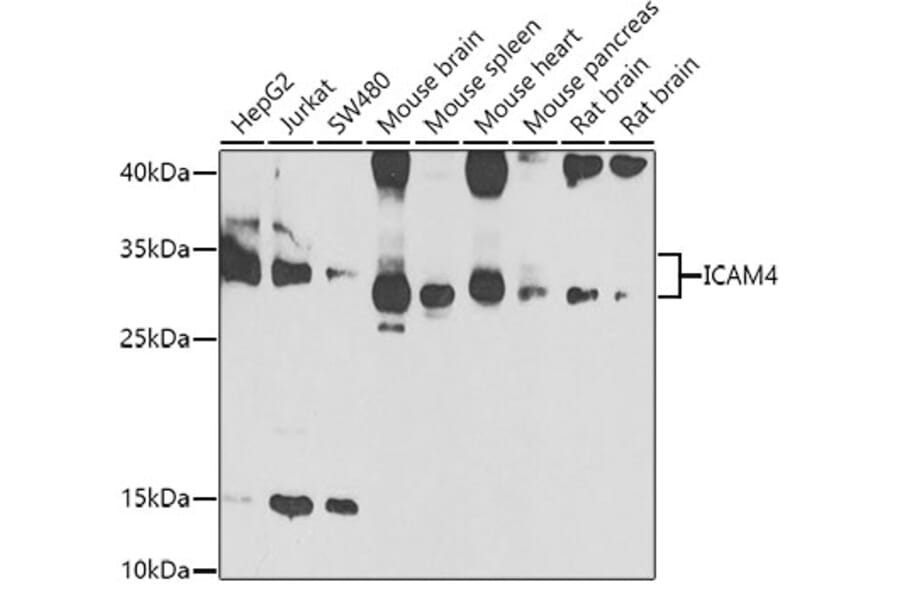 Western Blot - Anti-ICAM4 Antibody (A15697) - Antibodies.com