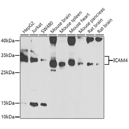 Western Blot - Anti-ICAM4 Antibody (A15697) - Antibodies.com