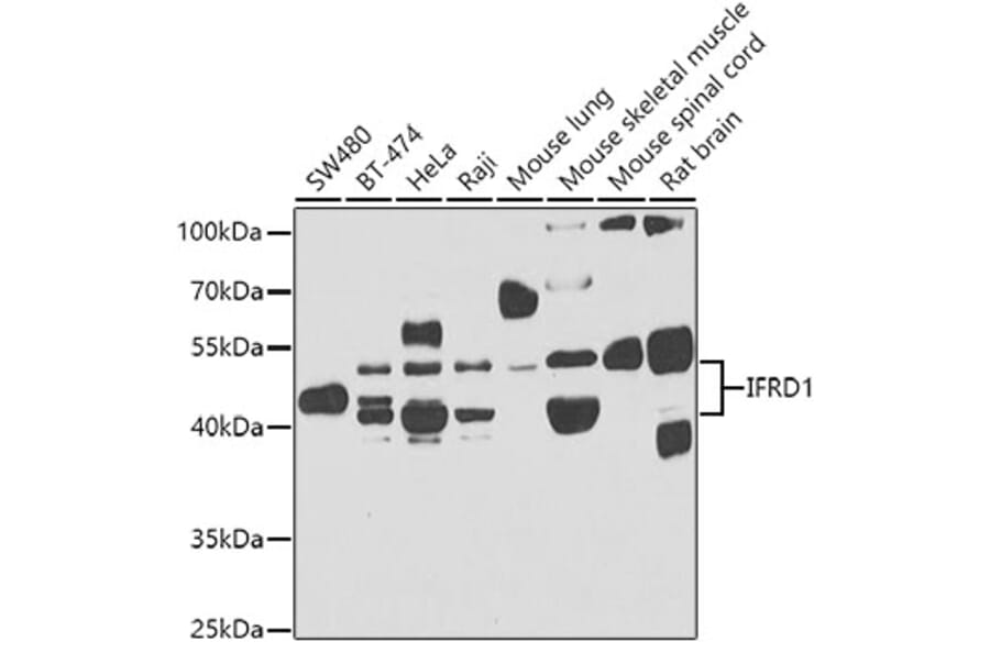Western Blot - Anti-IFRD1 Antibody (A15698) - Antibodies.com