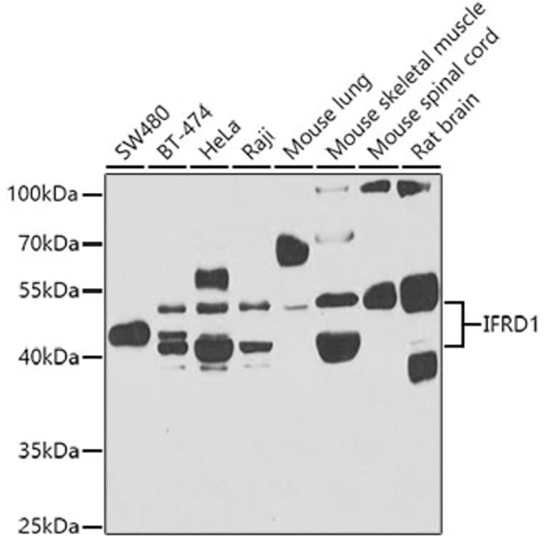 Western Blot - Anti-IFRD1 Antibody (A15698) - Antibodies.com