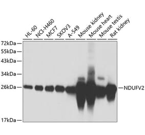 Western Blot - Anti-NDUFV2 Antibody (A15700) - Antibodies.com