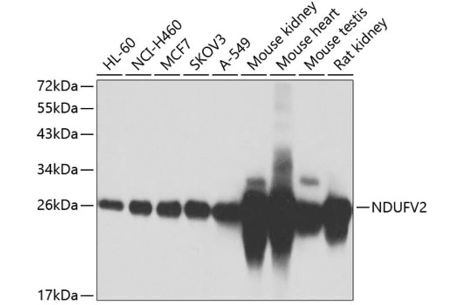 Western Blot - Anti-NDUFV2 Antibody (A15700) - Antibodies.com