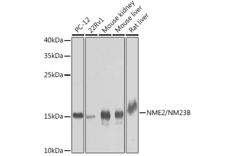 Western Blot - Anti-NME2 Antibody (A15701) - Antibodies.com