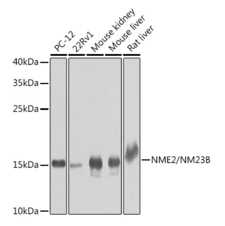 Western Blot - Anti-NME2 Antibody (A15701) - Antibodies.com