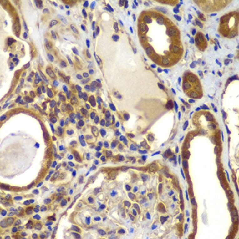 Immunohistochemistry - Anti-NME2 Antibody (A15701) - Antibodies.com