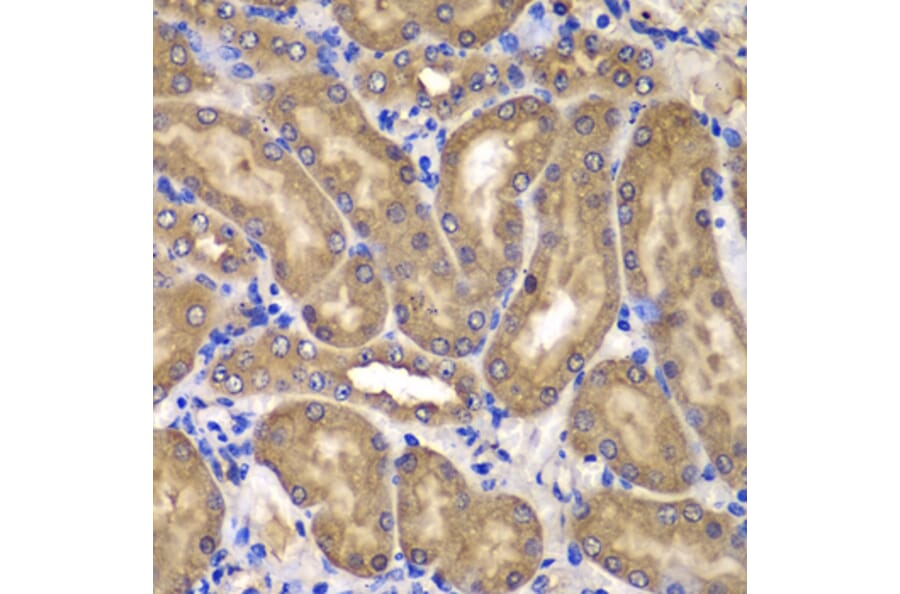 Immunohistochemistry - Anti-NME2 Antibody (A15701) - Antibodies.com
