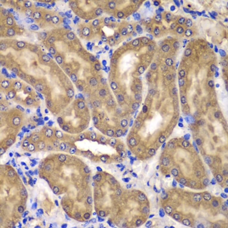 Immunohistochemistry - Anti-NME2 Antibody (A15701) - Antibodies.com