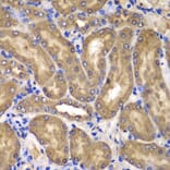 Immunohistochemistry - Anti-NME2 Antibody (A15701) - Antibodies.com