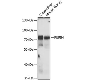 Western Blot - Anti-FURIN Antibody (A7445) - Antibodies.com