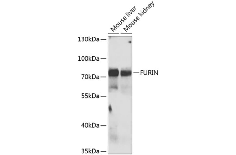 Western Blot - Anti-FURIN Antibody (A7445) - Antibodies.com