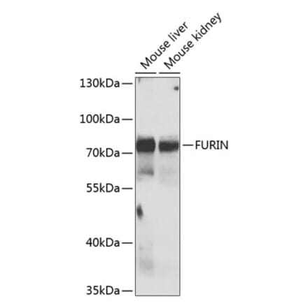 Western Blot - Anti-FURIN Antibody (A7445) - Antibodies.com