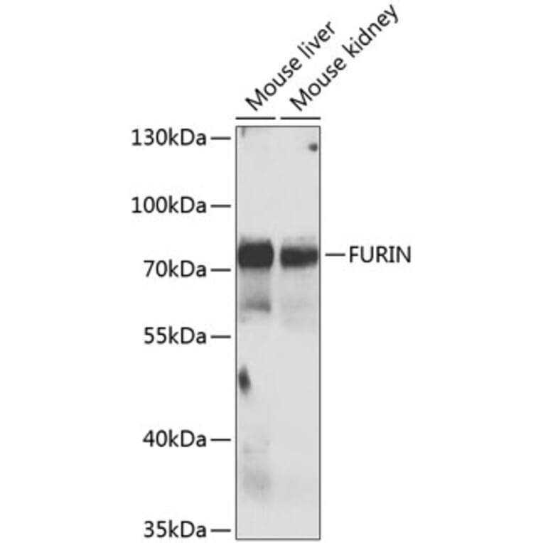 Western Blot - Anti-FURIN Antibody (A7445) - Antibodies.com